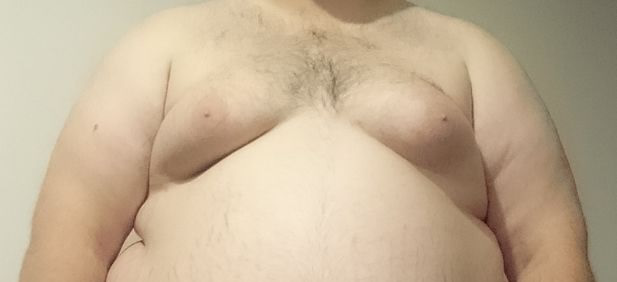 man boobs